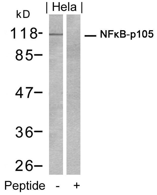Rabbit Polyclonal Antibody to NFkB-p105(Ab-932)