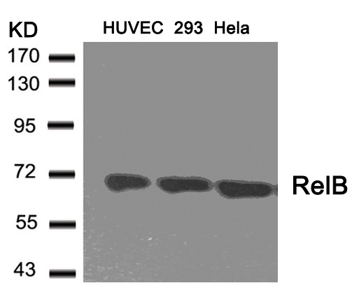 Rabbit Polyclonal Antibody to RelB(Ab-573)