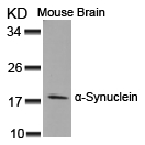 Rabbit Polyclonal Antibody to a-Synuclein(Ab-125)