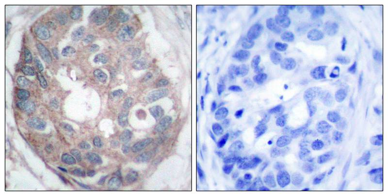 Rabbit Polyclonal Antibody to Dab1(Ab-232)