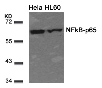 Rabbit Polyclonal Antibody to NFkB-p65(Ab-311)