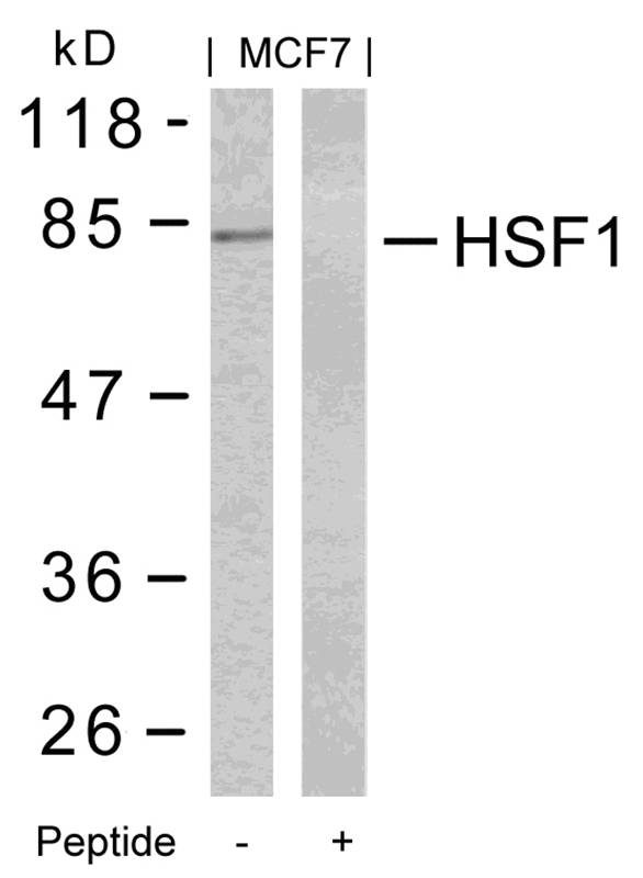 Rabbit Polyclonal Antibody to HSF1(Ab-303)