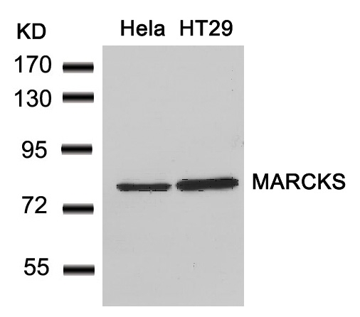 Rabbit Polyclonal Antibody to MARCKS(Ab-162)