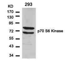 Rabbit Polyclonal Antibody to p7S6 Kinase(Ab-411)