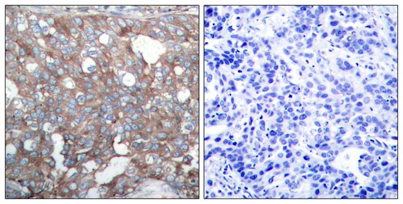 Rabbit Polyclonal Antibody to Cortactin(Ab-421)