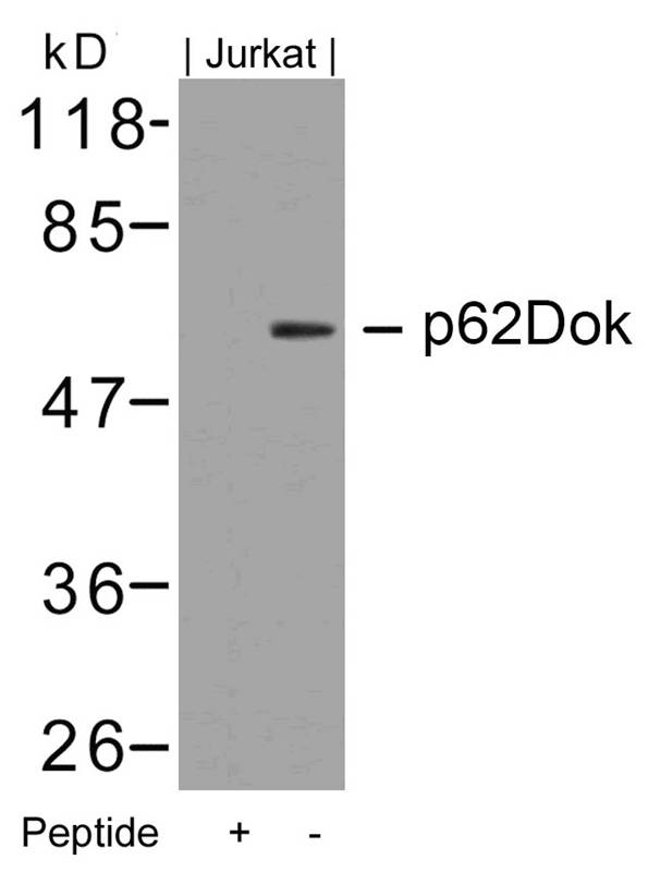 Rabbit Polyclonal Antibody to p62Dok(Ab-362)