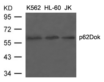 Rabbit Polyclonal Antibody to p62Dok(Ab-398)