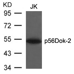 Rabbit Polyclonal Antibody to p56Dok-2(Ab-299)