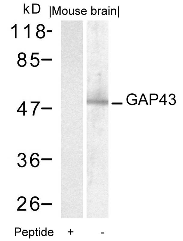 Rabbit Polyclonal Antibody to GAP43(Ab-41)