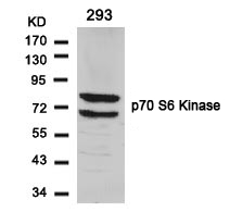 Rabbit Polyclonal Antibody to p7S6 Kinase(Ab-424)