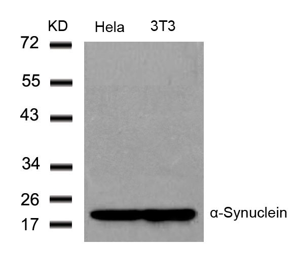 Rabbit Polyclonal Antibody to a-Synuclein(Ab-136)