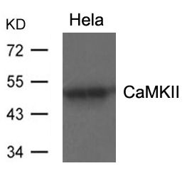 Rabbit Polyclonal Antibody to CaMKII(Ab-286)