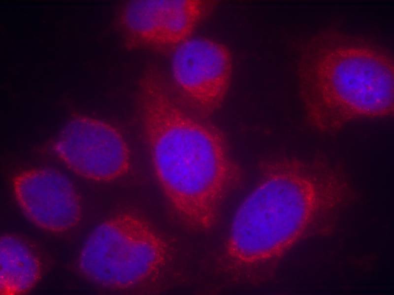 Rabbit Polyclonal Antibody to CPI17a(Ab-38)