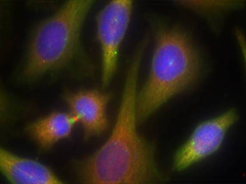 Rabbit Polyclonal Antibody to PKR(Ab-451)