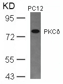 Rabbit Polyclonal Antibody to PKCd(Ab-645)