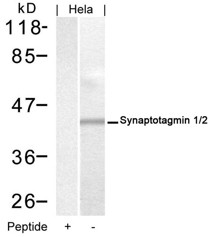 Rabbit Polyclonal Antibody to Synaptotagmin 1/2 (Ab-202/199)