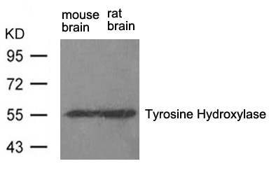 Rabbit Polyclonal Antibody to Tyrosine Hydroxylase(Ab-31)