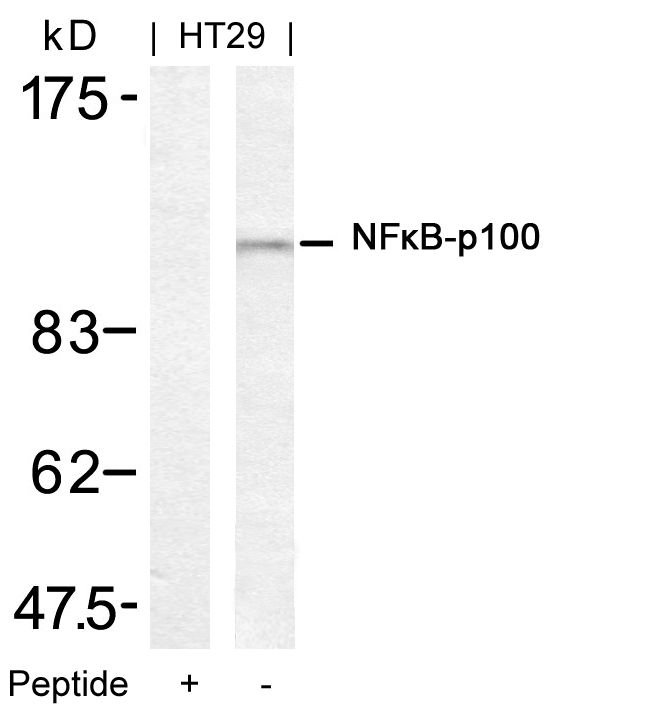 Rabbit Polyclonal Antibody to NFkB-p100(Ab-872)