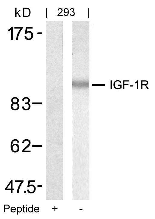 Rabbit Polyclonal Antibody to IGF-1R(Ab-1346)