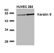 Rabbit Polyclonal Antibody to Keratin 8(Ab-74)