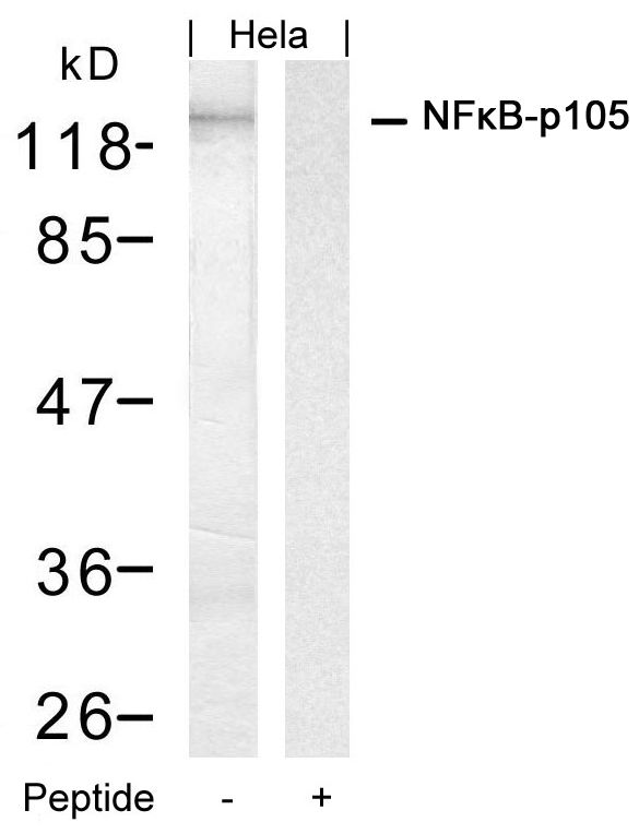 Rabbit Polyclonal Antibody to NFkB-p105(Ab-927)