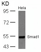 Rabbit Polyclonal Antibody to Smad1(Ab-465)