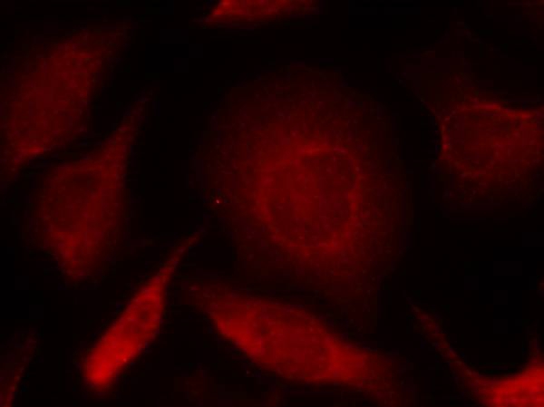 Rabbit Polyclonal Antibody to Smad3(Ab-208)