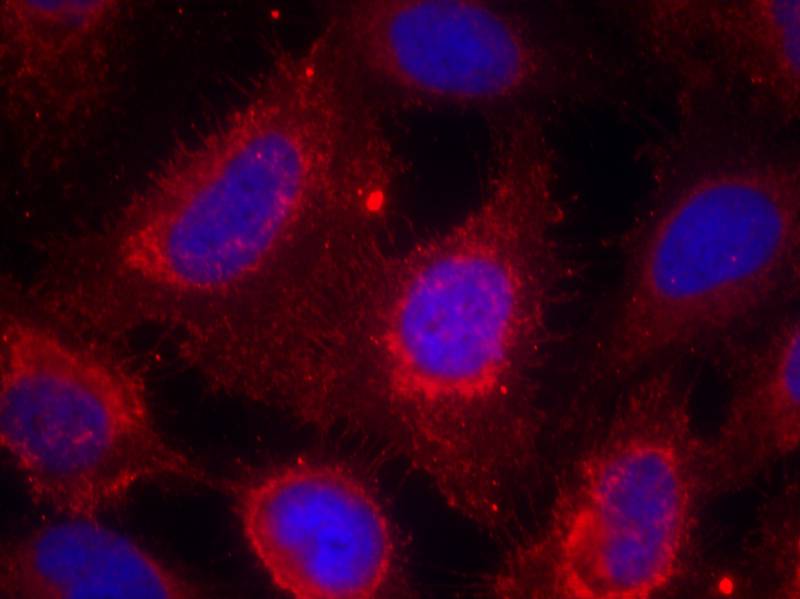Rabbit Polyclonal Antibody to TrkA(Ab-791)