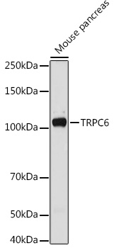Rabbit Polyclonal Antibody to TRPC6