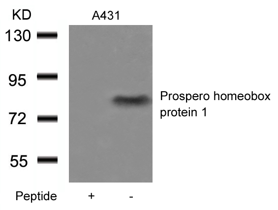 Rabbit Polyclonal Antibody to Prospero homeobox protein 1