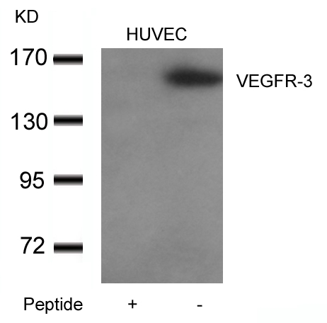 Rabbit Polyclonal Antibody to VEGFR3