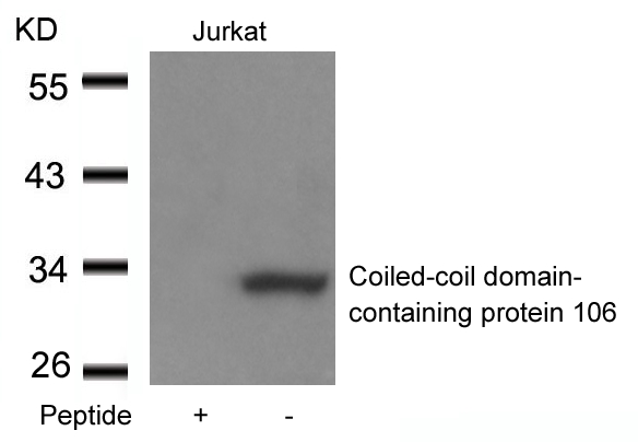 Rabbit Polyclonal Antibody to Coiled-coil domain-containing protein 106