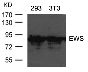 Rabbit Polyclonal Antibody to EWS