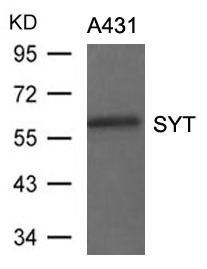 Rabbit Polyclonal Antibody to SYT