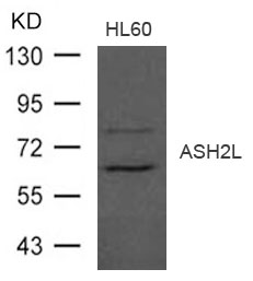 Rabbit Polyclonal Antibody to ASH2L