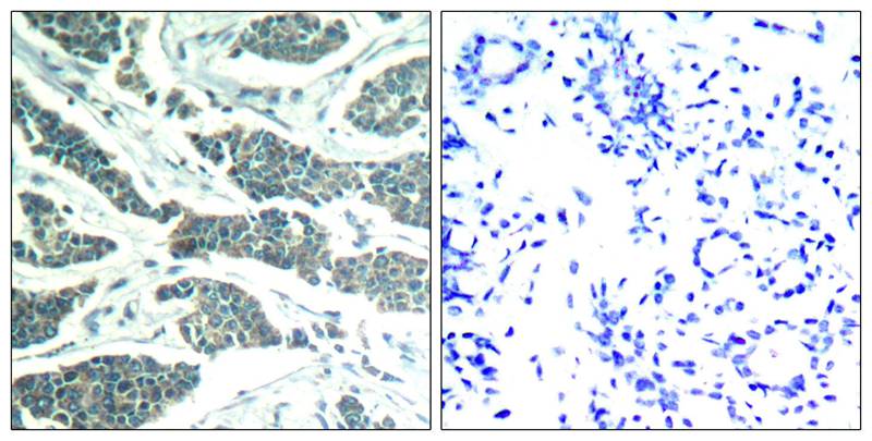 Rabbit Polyclonal Antibody to AKT1/AKT2/AKT3(Ab-315/316/312)