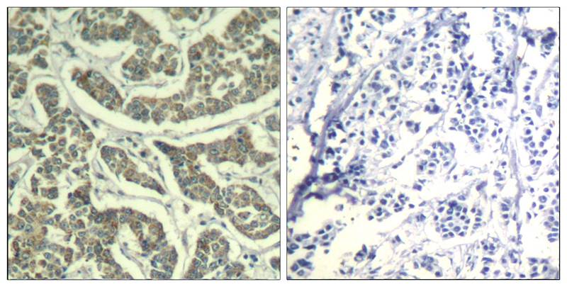 Rabbit Polyclonal Antibody to ATR(Ab-428)