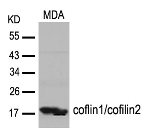 Rabbit Polyclonal Antibody to cofilin1/cofilin2(Ab-88)