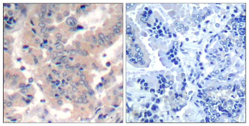 Rabbit Polyclonal Antibody to PI3 Kinase p85/p55(Ab-467/199)