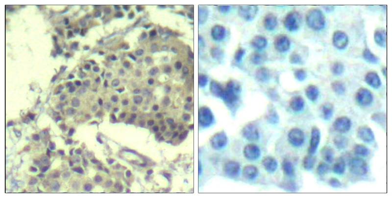 Rabbit Polyclonal Antibody to mTOR(Ab-2481)
