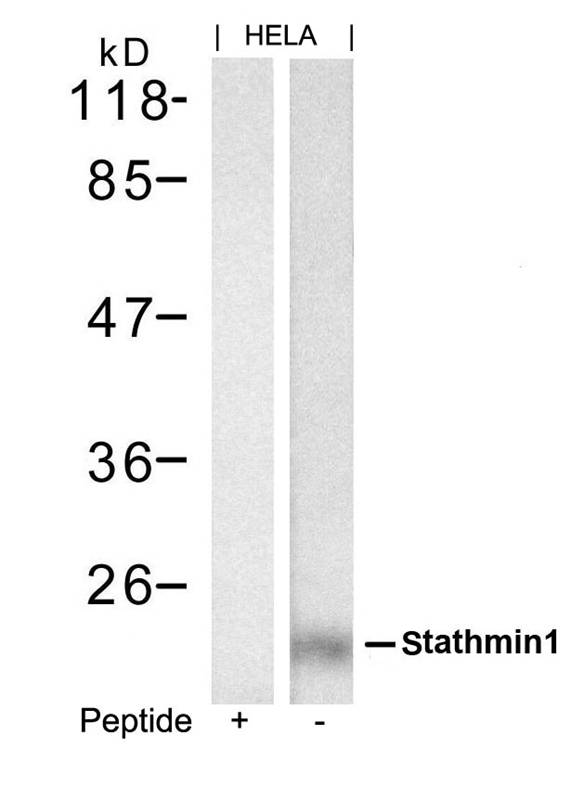 Rabbit Polyclonal Antibody to stathmin1(Ab-62)