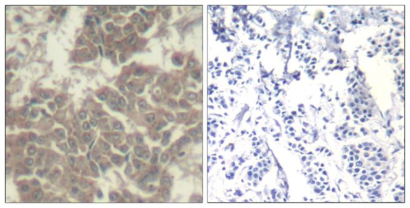 Rabbit Polyclonal Antibody to Jak2(Ab-570)