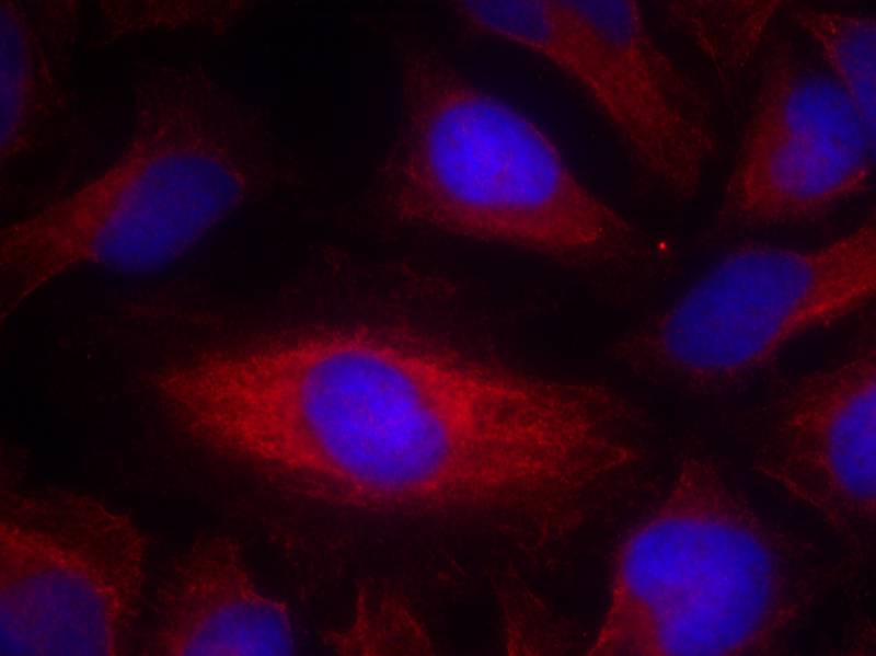 Rabbit Polyclonal Antibody to PLC-g2(Ab-1217)