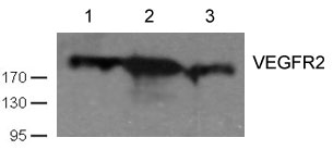 Rabbit Polyclonal Antibody to VEGFR2(Ab-1059)