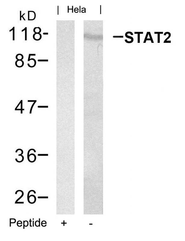 Rabbit Polyclonal Antibody to STAT2(Ab-690)