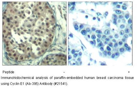 Rabbit Polyclonal Antibody to Cyclin E1 (Ab-395)