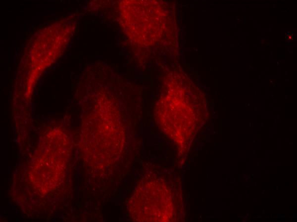 Rabbit Polyclonal Antibody to CDK6(Ab-13)