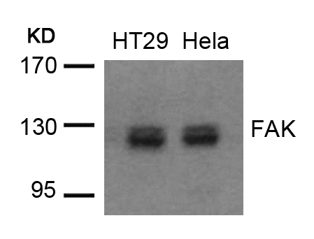 Rabbit Polyclonal Antibody to FAK(Ab-576/577)