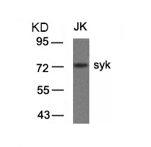 Rabbit Polyclonal Antibody to syk(Ab-323)
