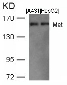 Rabbit Polyclonal Antibody to Met(Ab-1003)